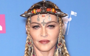 Madonna May Have Taken Plastic Surgery and Cosmetic Procedures 'Little Too Far,' Says Experts
