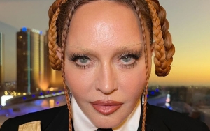 Madonna Blames 'Ageism and Misogyny' for Intense Criticism Over Youthful Appearance at Grammys