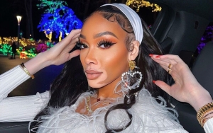 Winnie Harlow Determined to Ensure the 'Lane' She Set in Modelling Industry Is Not Just 'Tokenism'