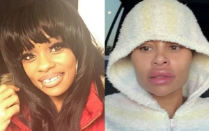 Tokyo Toni Goes Off on People Praising Blac Chyna for Reducing Her Cosmetic Surgeries