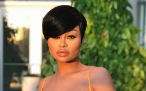 Blac Chyna Steps Out for First Time After Having Face Filler Dissolved