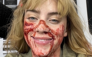 Billie Eilish Unleashes Gruesome Selfies From 'Swarm' Set