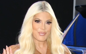 Tori Spelling Sports Bruises After Being Released From Hospital