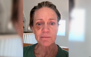 Former Miss America Runner-Up Cullen Johnson Hill Says Addiction Makes Her Look Like 'Crap' 
