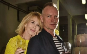 Sting's Wife Trudie Recalls 'Cruel' Bullying at School Due to Her Facial Scars