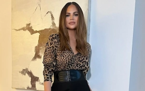 Chrissy Teigen Shows Off Injuries From Super Bowl Party