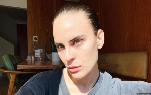 Tallulah Willis Posts Selfie After Dissolving Her Facial Fillers: 'I Was Scared'