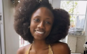 'So You Think You Can Dance' Alum Korra Obidi Recalls Gruesome Attack in London