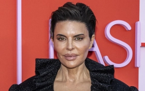 Lisa Rinna Addresses Facial Fillers, Dissolves Injections