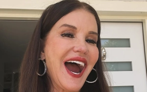 Janice Dickinson Reveals She Got First Plastic Surgery at This Age