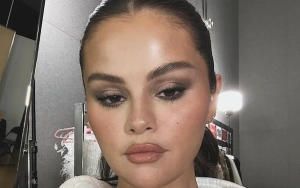 Selena Gomez Is Saddened by Plastic Surgery Speculation, Admits to Having Botox
