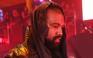 Kanye West Asked for Nitrous Gas in Surfaced Text Despite His Dentist's Denial to Addiction Claims