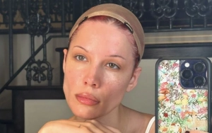 Halsey Refuses to Look at Her 'Ugly' Self in Mirror at Height of Her Battle With Lupus