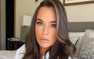 Teddi Mellencamp Reveals Four Tumors Have Been Removed From Her Brain: 'The Fight Is Not Over' 