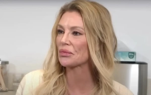 Brandi Glanville Taken to Hospital in Ambulance Amid Struggle With Facial 'Parasites'