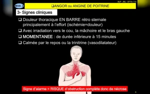 Demand for Quebec Band Angine de Poitrine Surges After Viral KEXP Video