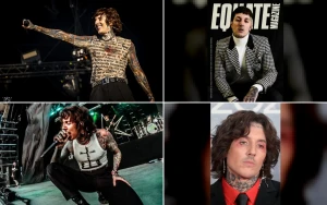 Bring Me the Horizon’s Oli Sykes Suffers Mild Concussion After Phone Hits Him