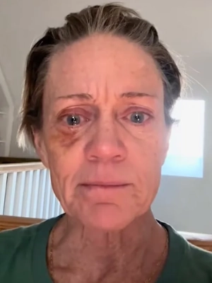 Former Miss America Runner-Up Cullen Johnson Hill Says Addiction Makes Her Look Like 'Crap' 