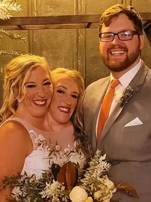 Conjoined Twin Abby Hensel Ties the Knot With Josh Bowling