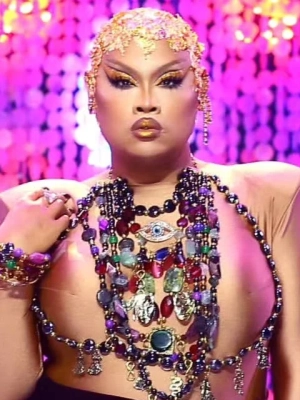 'RuPaul's Drag Race' Alum Jiggly Caliente Has Her Leg Amputated Due to 'Severe Infection'