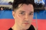 Danny O'Donoghue Suffers Broken Rib Following Playful Spar With Bandmate