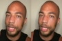Kendrick Sampson Shows Off Injuries From Being Beaten and Shot at During Los Angeles Protest