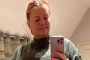 Kerry Katona Unable to Breathe as Her Body Is Swollen Following Cosmetic Surgeries