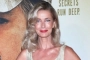 Paulina Porizkova Vows to Embrace Scars From Hip Replacement Surgery