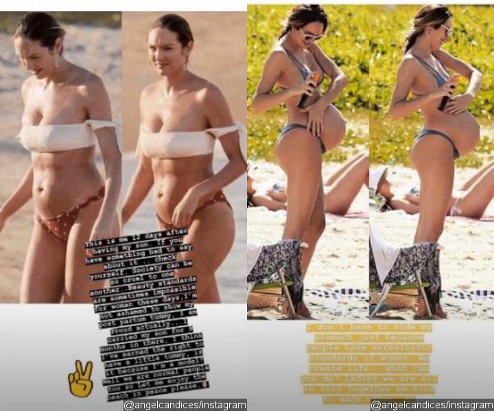 Candice Swanepoel fires back at haters by posting post-pregnancy photo of herself