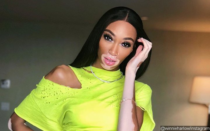 Winnie Harlow Clarifies Her Controversial 'ANTM' Comments