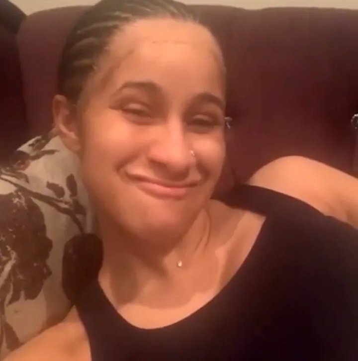 Cardi B Reveals Receding Hairline in an Instagram Video