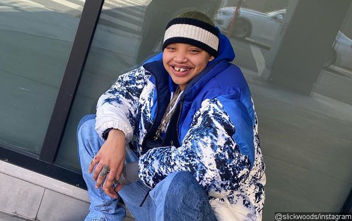 Model Slick Woods Sparks Concern With Photo of Herself After Suffering Another Seizure