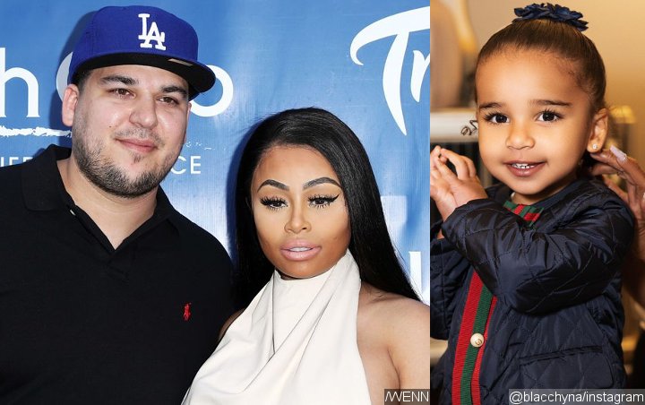 Rob Kardashian Investigated After Blac Chyna Claims Dream Has Severe Burns While in His Care