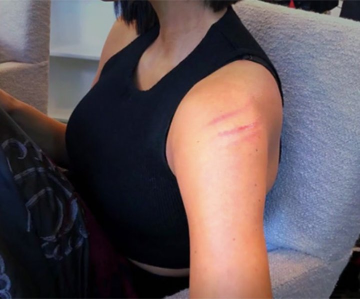 Kim is injured following fight with Kourtney Kardashian