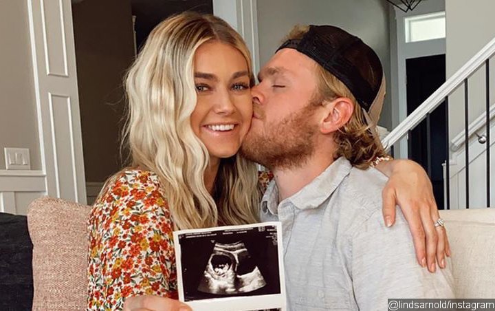 Lindsay Arnold of 'Dancing With the Stars' Is Expecting First Child, Fellow Pro-Dancers Rejoice