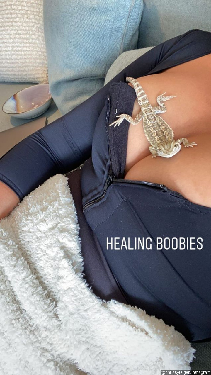 Chrissy Teigen's IG Story
