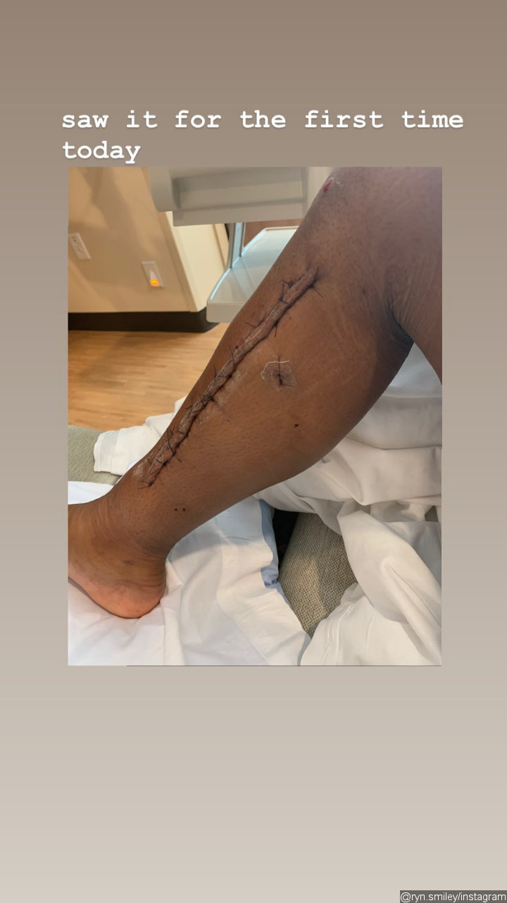 Rickey Smiley's Daughter Aaryn Shares Update After Shooting