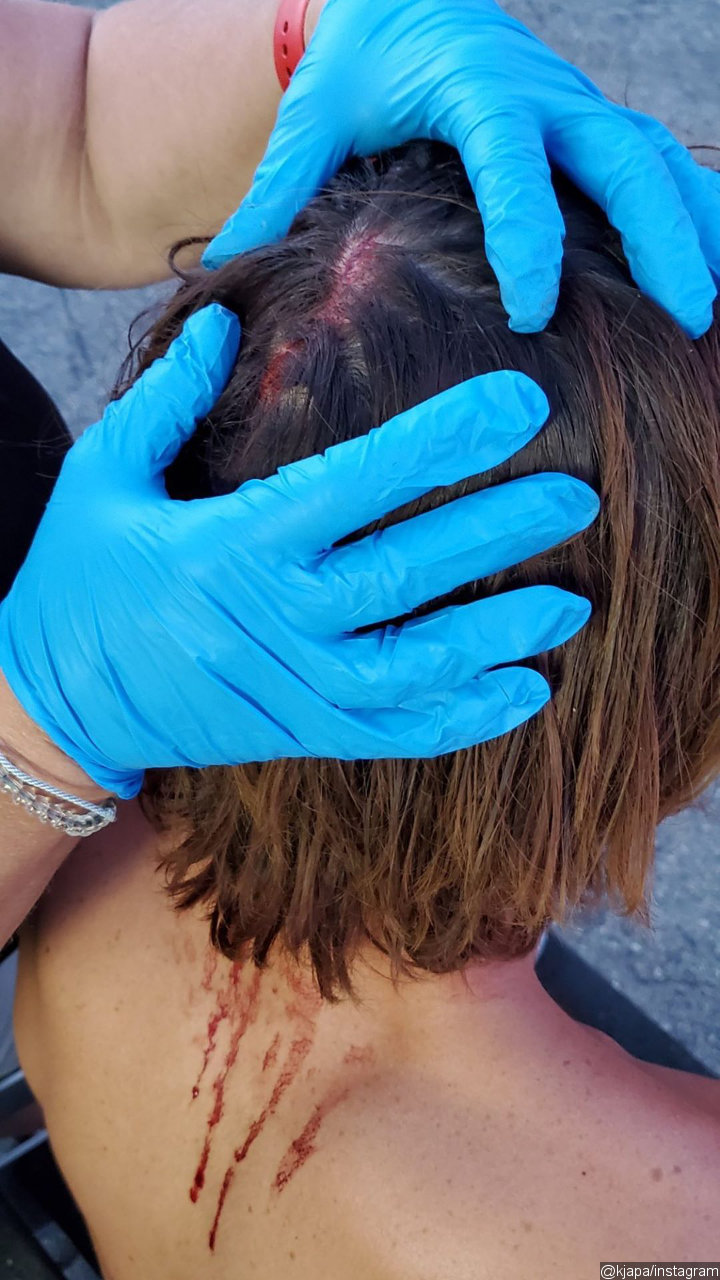 KJ Apa Injured on 'Songbird' Set