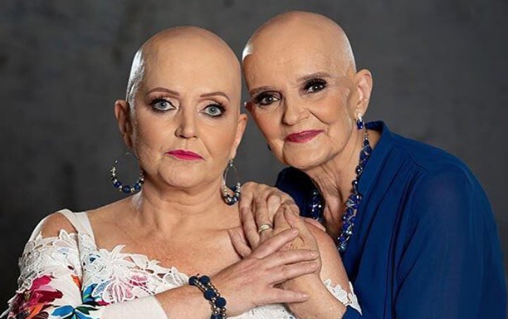Linda and Anne Nolan Unveiled to Have Undergone Chemotherapy Together in Their Cancer Battle