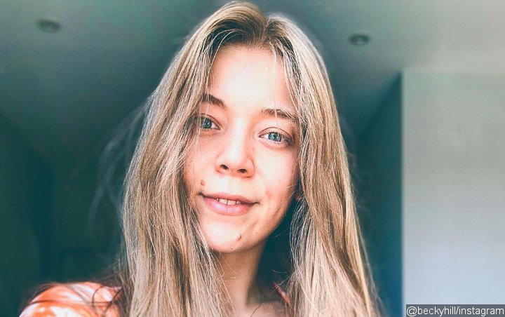 Becky Hill Voices Frustration Over Secondary Treatment of Female Musicians on Radio