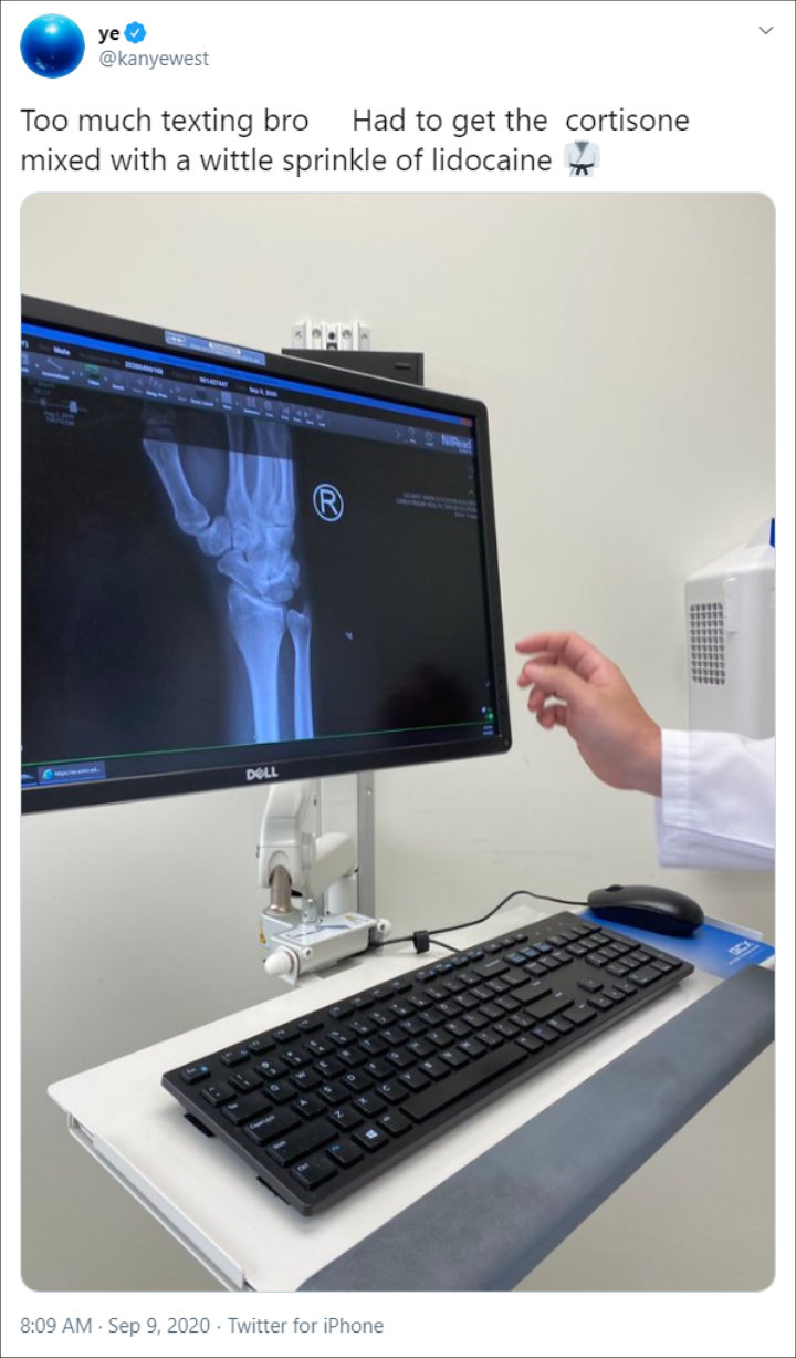 Kanye West's Hand Injury
