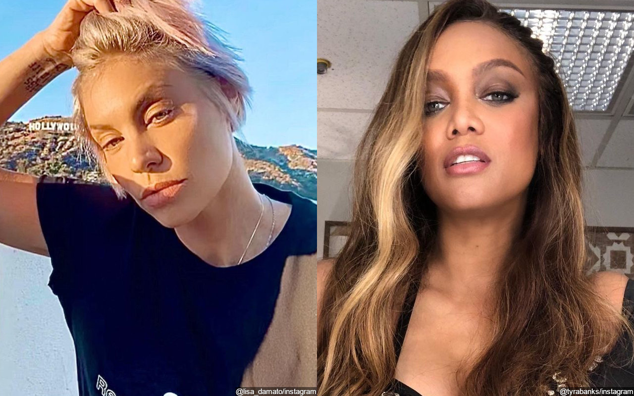 'ANTM' Alum Lisa D'Amato Accuses Tyra Banks of Using Her 'Childhood Trauma' Against Her