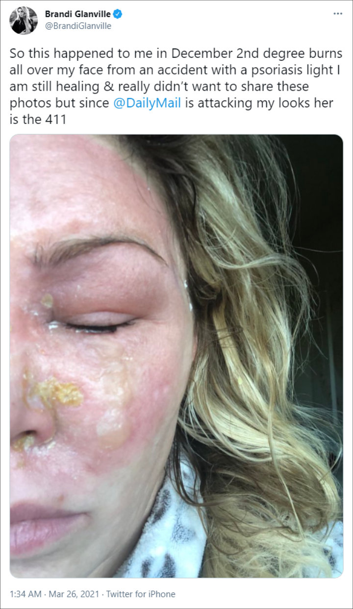Brandi Glanville's Tweet