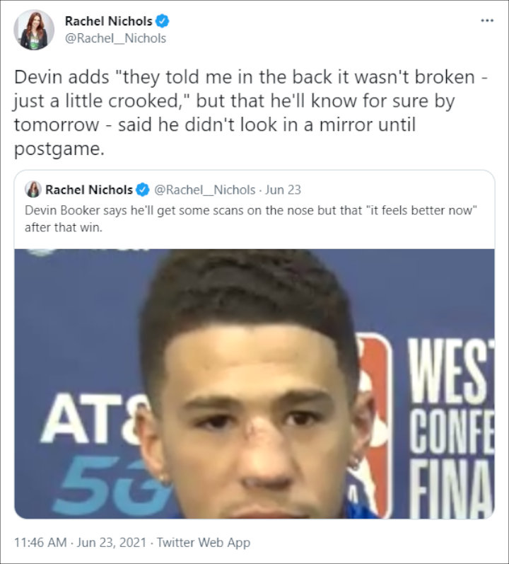 devin booker broken nose