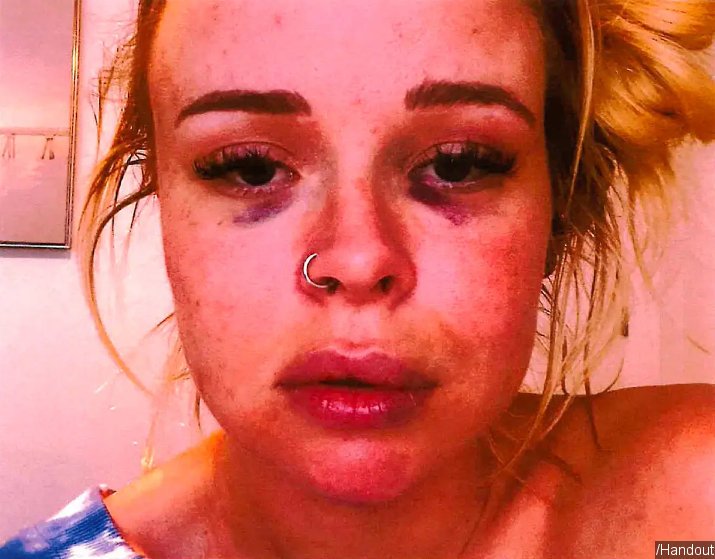 Photo of Trevor Bauer's accuser