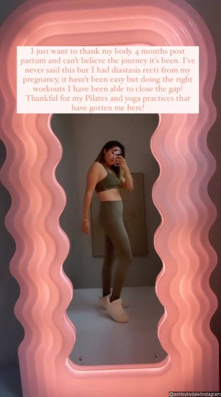 Ashley Tisdale opened up about her diastasis recti diagnosis