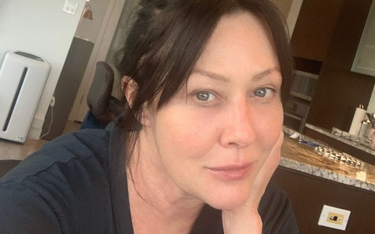 Shannen Doherty Plastic Surgery: The Truth Behind The Transformations