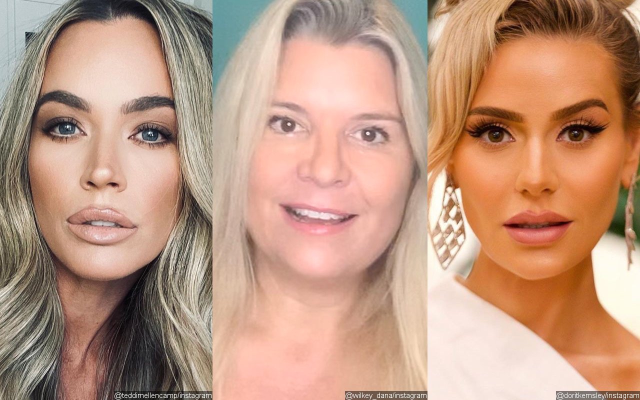 Teddi Mellencamp Appears to Blame Dana Wilkey for Dorit Kemsley Robbery