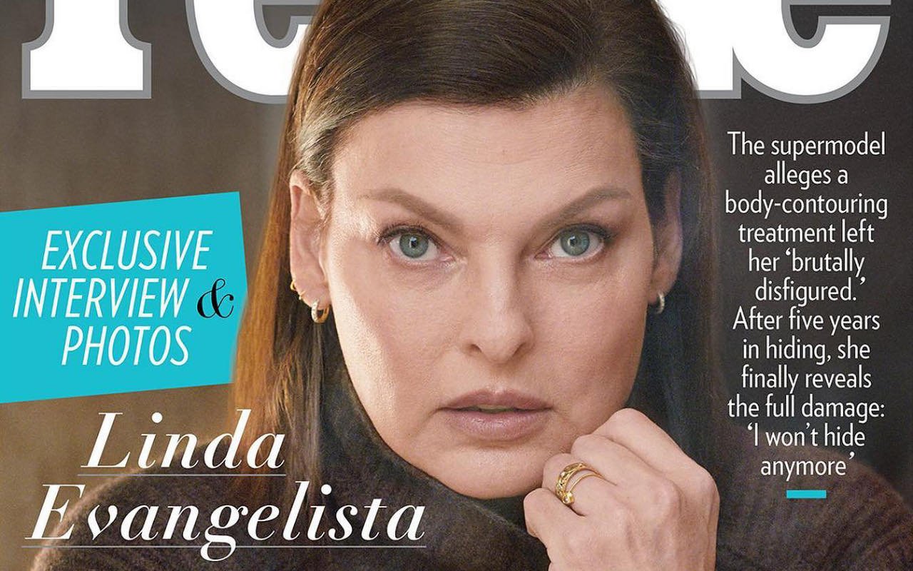 Linda Evangelista Shows Her Body for First Time After Botched Surgery Left Her 'Brutally Disfigured'