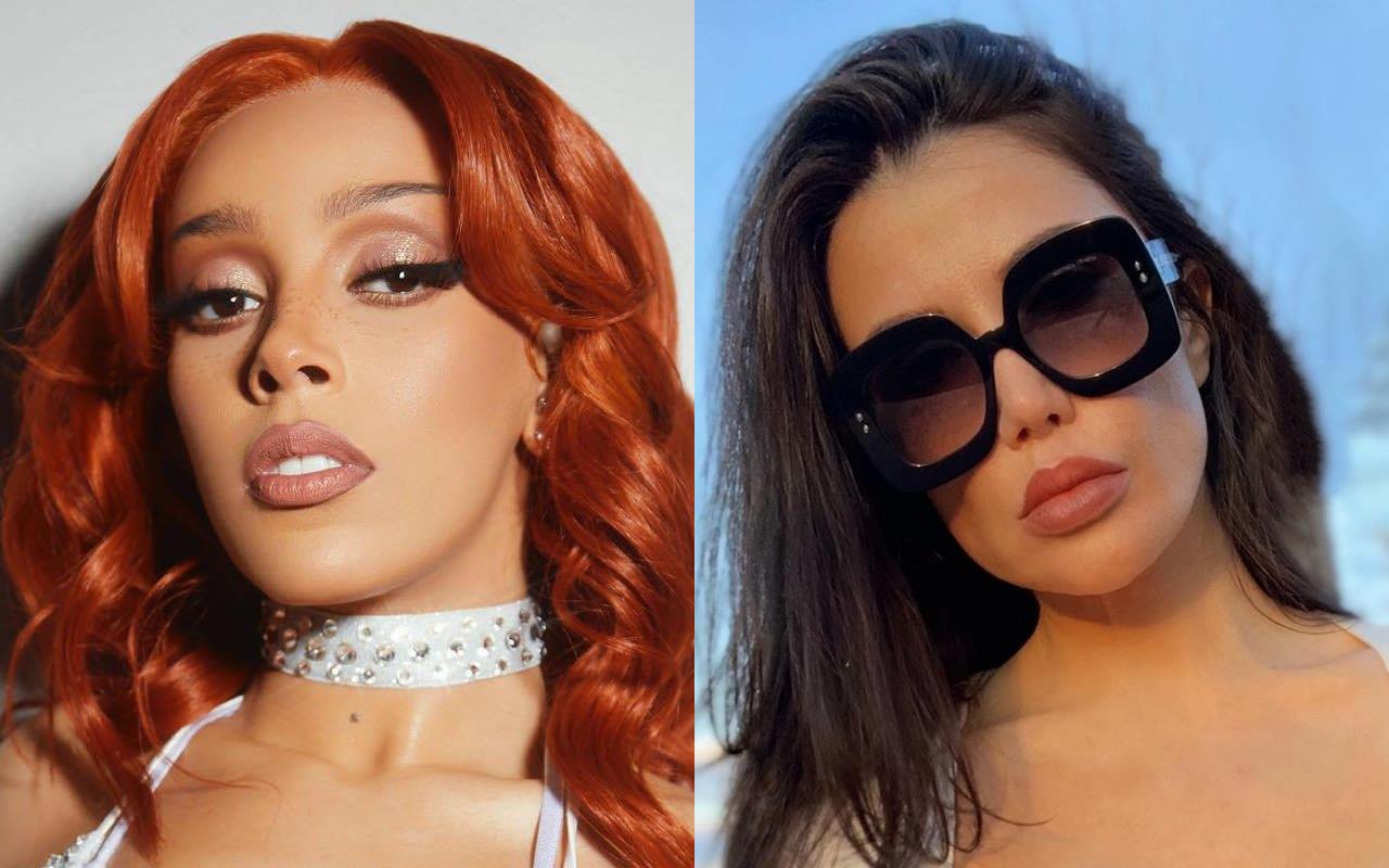 Doja Cat Rips YouTuber Lorry Hill for Accusing of Getting Plastic Surgery